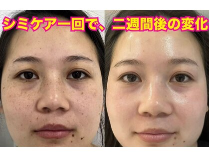 東洋経絡エステ アンド リラクゼーションの写真