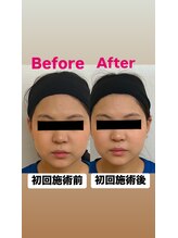 ゆうはり鍼灸整骨院 恵比寿/お客様Before　After