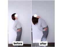 イトウ カイロプラクティックパートナー(ITOU)/Before &After