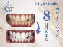 ラフ(LAUGH)/【審・美・白】 ホワイトニング