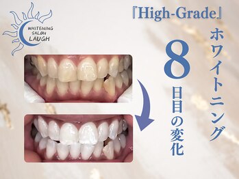 ラフ(LAUGH)/【審・美・白】 ホワイトニング