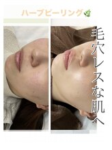 バーグトータルビューティー(bague total beauty)/ターンオーバーを促し美肌へ