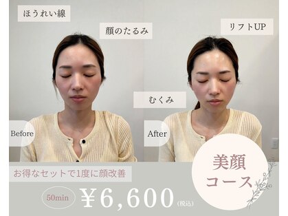 マヴィ(mavie)の写真