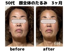 フェリーチェ(FELICE)/◆見た目変わると楽しい毎日に♪