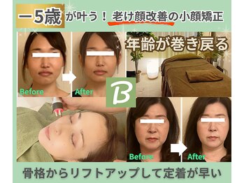 ベルソー(Berceau)