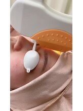 ローズ(Rose)/顔脱毛