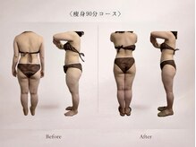 ベルミナ(Belmina)/大名/天神/毛穴/脱毛/痩身