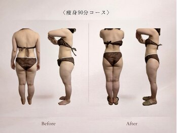 ベルミナ(Belmina)/大名/天神/毛穴/脱毛/痩身