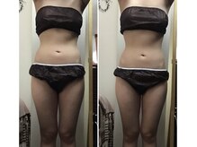 ミマインズ 倉敷本店(Me Mines)/引き締めBODYを手に入れる