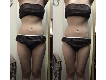 ミマインズ 倉敷本店(Me Mines)/引き締めBODYを手に入れる