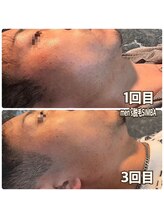 シンバ 倉敷店(SIMBA)/