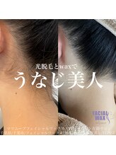 エリス(ELISSE)/うなじ脱毛でうなじ美人