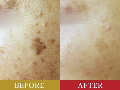 エステティックガーデン小町ストーリーの写真