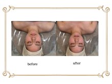 エコム(ECOM)/リンパを流してむくみ知らず