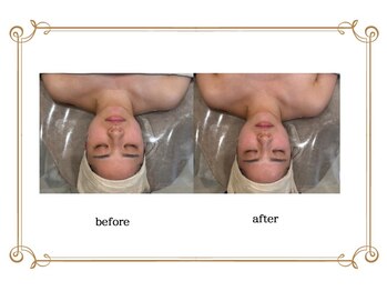 エコム(ECOM)/リンパを流してむくみ知らず