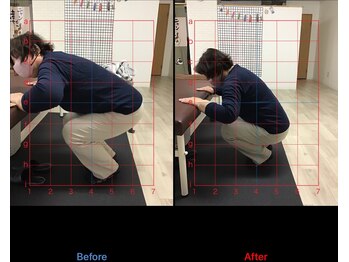 ストレチックス 近江八幡店/BeforeAfter