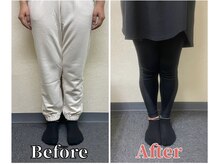 整体ラルース 中目黒(LALUZ)/20代　女性　XO脚改善　変化