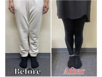 整体ラルース 中目黒(LALUZ)/20代 女性 XO脚改善 変化