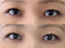 シャール(shall)/まつ毛パーマ/まつげ/マツパ