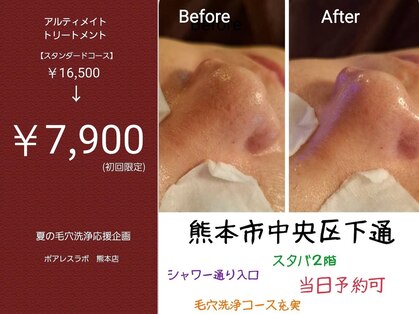 ポアレスラボ 熊本店の写真