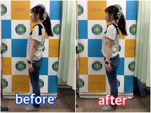 ベスト整骨院/後傾していた上半身が真っすぐに