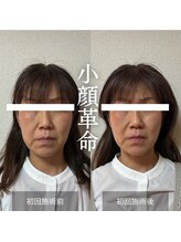 ザ リフト カドモリ 鹿児島 霧島(The Lift KADOMORI)/Before→After