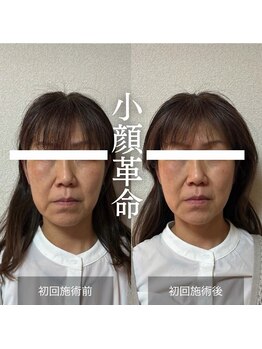 ザ リフト カドモリ 鹿児島 霧島(The Lift KADOMORI)/Before→After