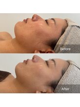 ラリュンヌ(La Lune)/