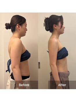 リバース 大阪店(Rebirth)/脂肪燃焼剤１０mlハイパーナイフ