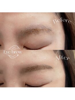 ビオラス(Biolus)/【眉毛/まゆげ】Before/After
