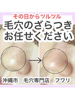 フワリ/小鼻もツルツルに