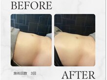 モンド(Mondo)/レモンボトル