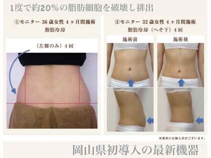 シュシュ(chouchou)の写真