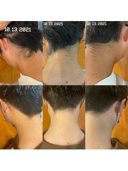 ベル(Belle)の写真/選べる3パーツメンテナンス脱毛!うなじ脇足背中など気になる箇所を整える特別時間♪