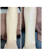 サナ 久が原 千鳥町(S’ana)/ハンドスペシャルトリートメント