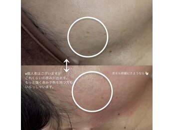 ループラス 中目黒(r'oo plus)/フェイスワックス