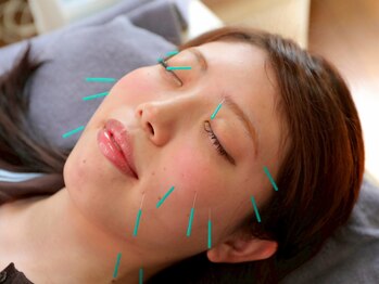 ながたともひさ指圧はり灸治療院/美容鍼の施術で小顔効果