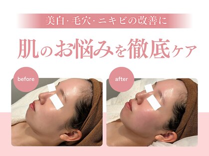 アイラブワン(eye love one)の写真