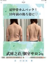 エデン(Eden)/背中のお肉を撃退、肩甲骨出現♪