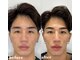 イロハ(IROHA)の写真/《美容男子/お肌をキレイにしたい男性はIROHAへ》毛開き・黒ずみ/凹凸肌/ニキビにお悩みの方に◎