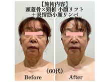 マルウル(maluulu)の雰囲気（初回から感動レベルの変化！最近、若返った？と聞かれるかも♪）