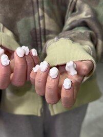 埋め込みネイル