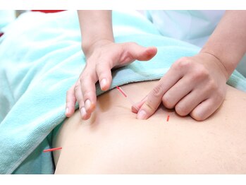 荻窪接骨院 荻窪治療室/鍼灸メニュー