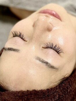 チュチュ(TUTU)の写真/【長崎県長崎市】話題の水光肌作り/ハーブピーリング専門店★肌悩みの改善で理想のつるんとたまご肌に♪