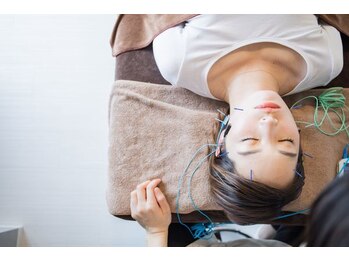 リコア鍼灸接骨 丸ビル(ReCORE鍼灸接骨)/美容鍼☆