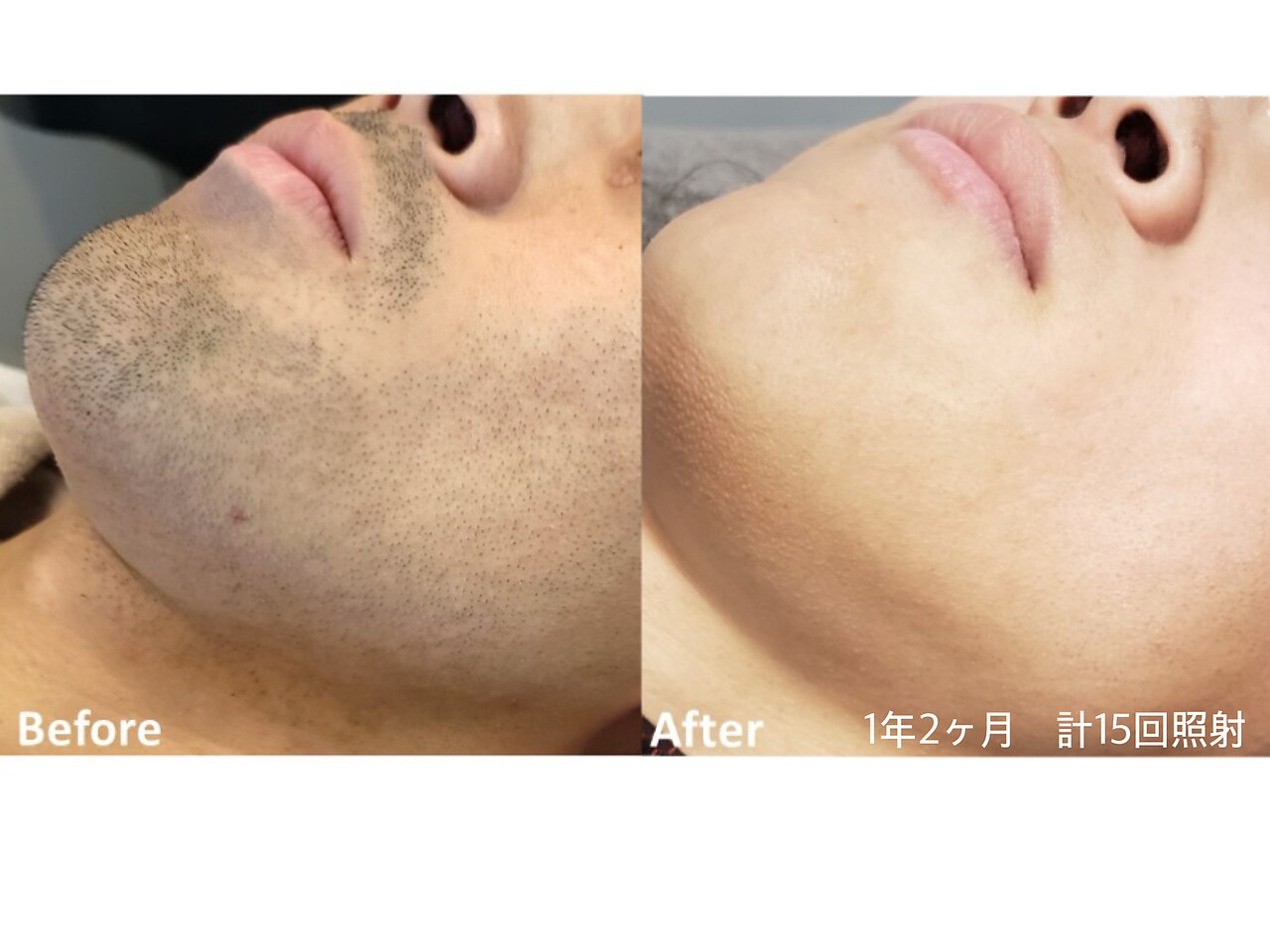 横須賀市で美肌が人気のエステサロン｜ホットペッパービューティー