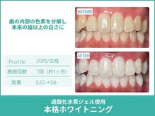 クレア(Crea)の雰囲気（圧倒的効果で理想の白さを手に入れることができます！）