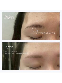 ビオラス(Biolus)/【眉毛/まゆげ】Before/After