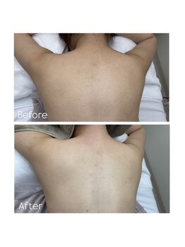 39 beauty salon.横浜関内【WAX脱毛/メンズ眉毛/水素吸入しながら】/背中Wax