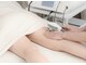 リアレント 高槻店(Lialent)の写真/【本気の美脚】太もも・ヒップを徹底サイズダウン《発汗＋下半身集中インディバ痩身70分16,500円》
